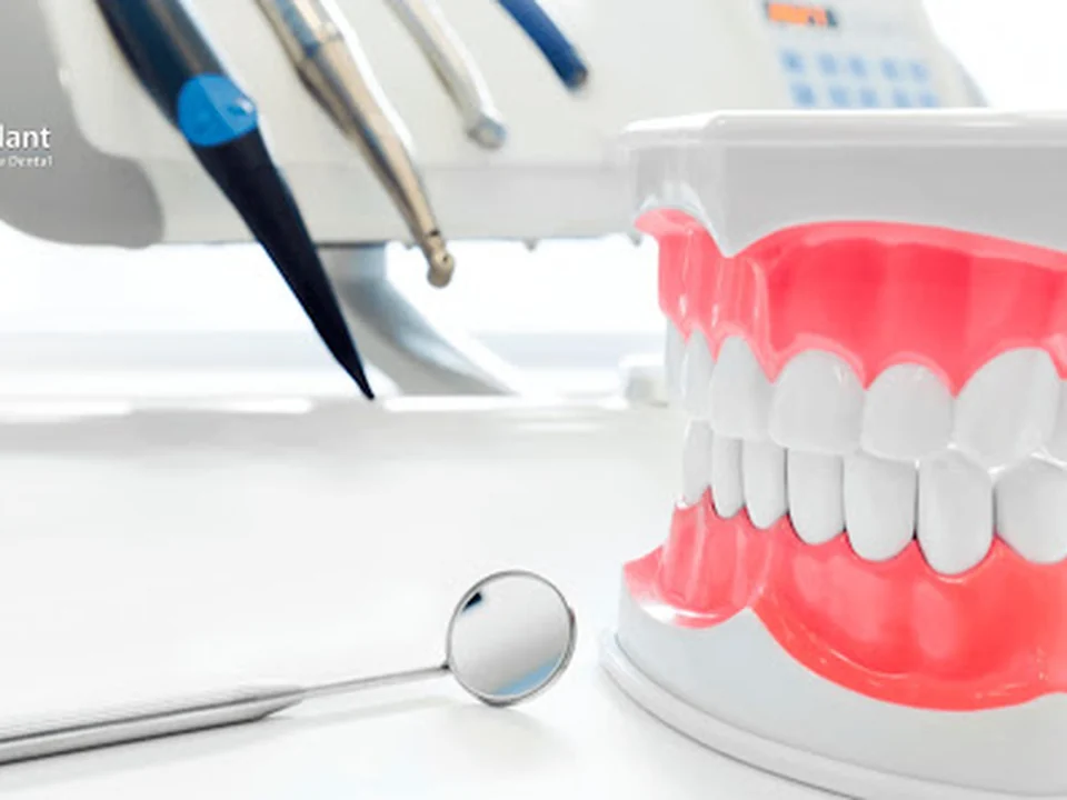 Implantes Dentales | Dr. Ricardo Molina, Ciudad de México