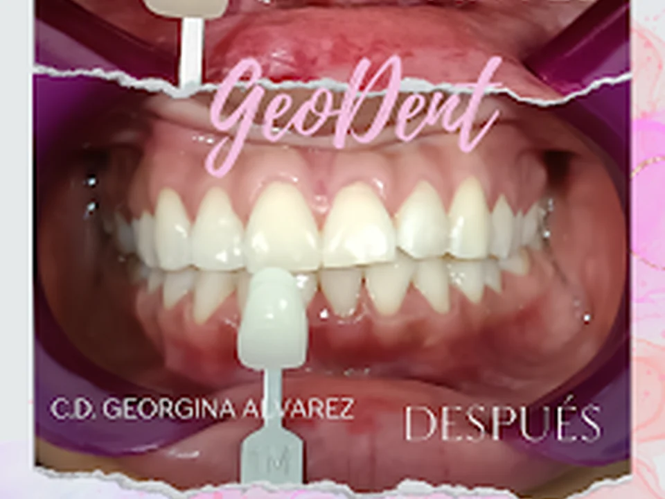 GEODENT C.D.Georgina Alvarez| Dentista, Odontología Estética, Cirugía Maxilofacial, Ortodoncia, Odontopediatra., Ciudad de México