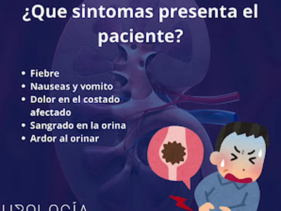 Urologo CDMX | Iztapalapa Dr Said De La Paz, Ciudad de México
