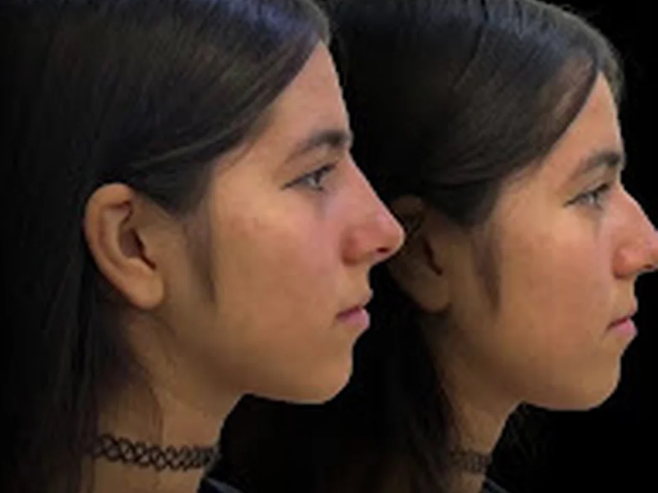 HAAR MEDICAL, Medicina Estética & Restauracion Capilar, Ciudad de México
