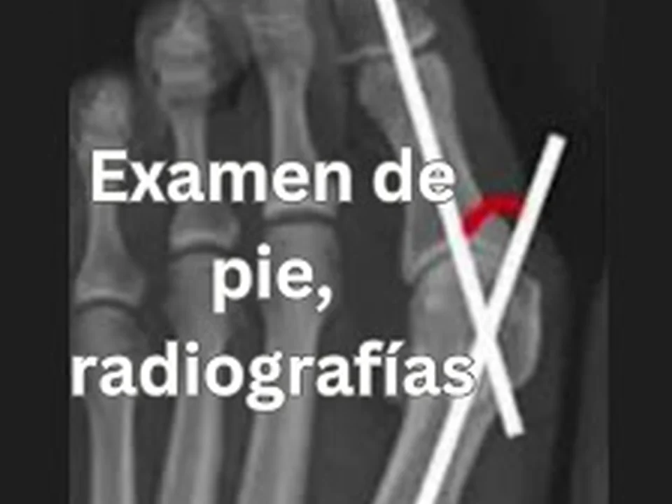 UltraMed | Plantillas Personalizadas | Fisioterapia |, Ciudad de México