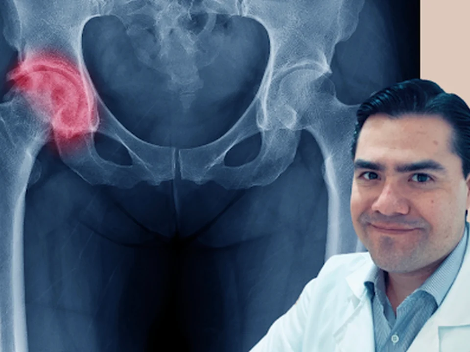 Dr. Ruperto Alfonso Muñoz Galguera, Ortopedista, Ciudad de México