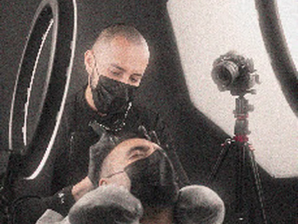 Bollywood Scalp: Micropigmentación Capilar en México, Ciudad de México