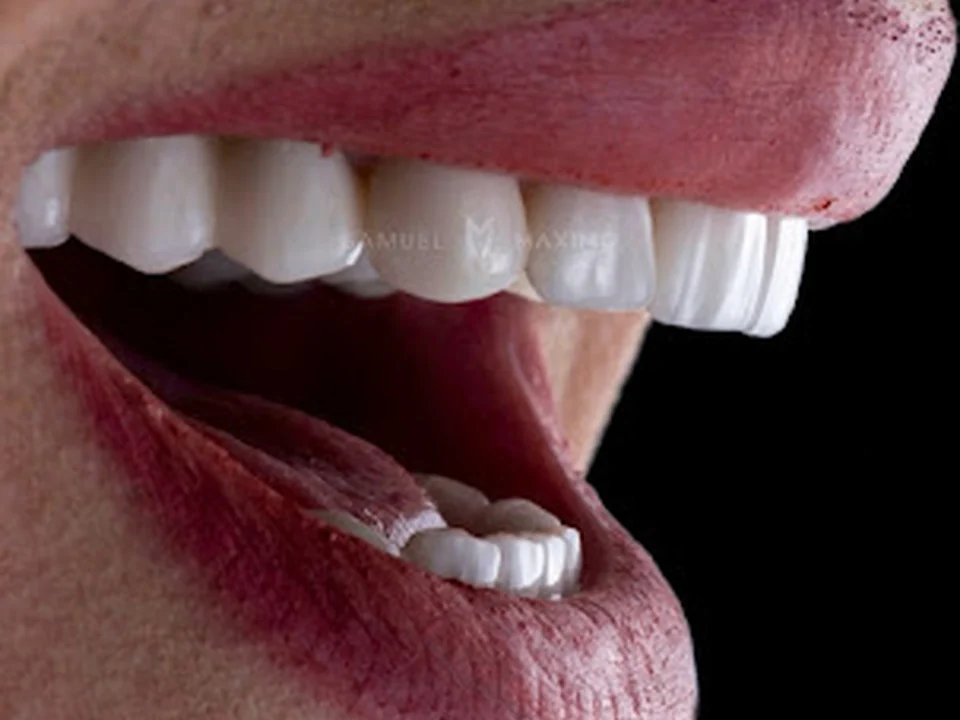 Clínica Dental Samuel Máximo- Dentista 24 horas Urgencias, Ciudad de México