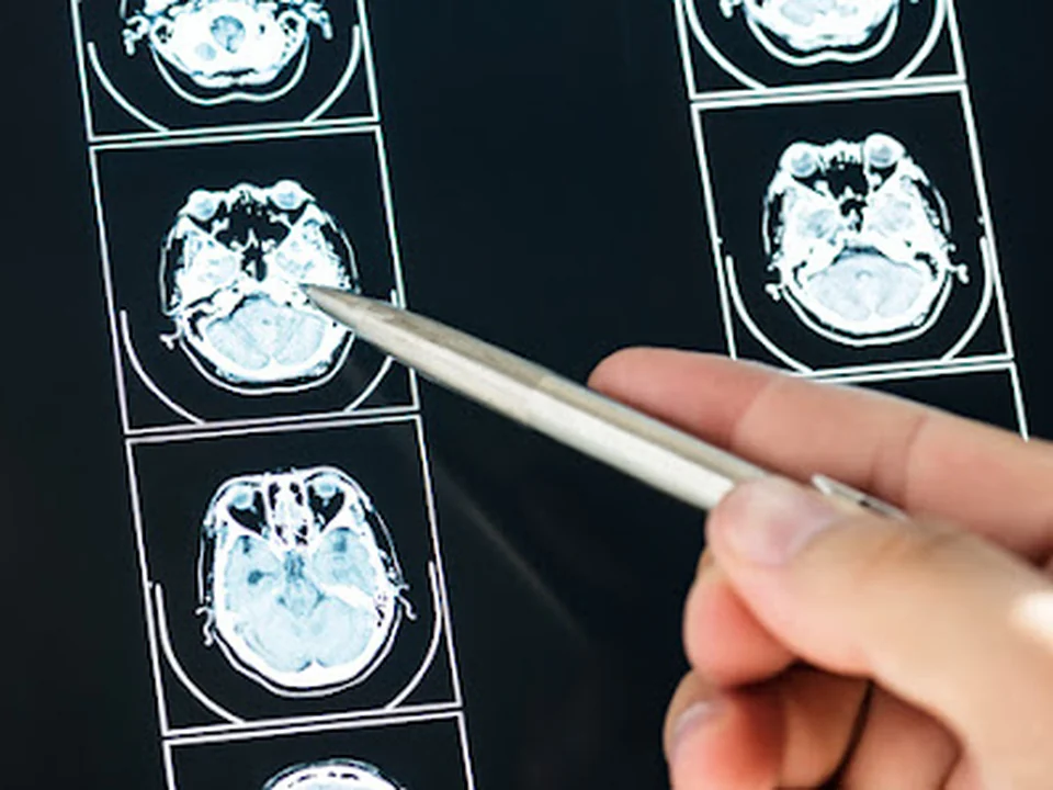 Neurocirujano en Lindavista, CDMX - Dr. José Alejandro Romero Acosta, Ciudad de México