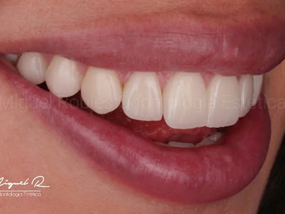 Dr. Miguel Robles - Odontología Estética, Ciudad de México